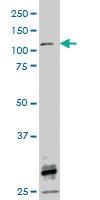 Anti-FGFR1 Mouse Monoclonal Antibody [clone: 3C9]