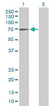 Anti-DCLRE1C Rabbit Polyclonal Antibody