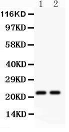 Anti-CD3 Epsilon Polyclonal Antibody