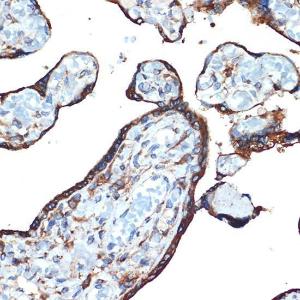 Immunohistochemistry analysis of paraffin-embedded human placenta using Anti-LMAN1 Antibody [ARC1978] (A306904) at a dilution of 1:100 (40X lens). Perform microwave antigen retrieval with 10 mM Tris/EDTA buffer pH 9.0 before commencing with IHC staining protocol