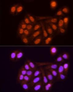 Immunofluorescence analysis of U2OS cells using Anti-KPNA3 Antibody (A12240) at a dilution of 1:100 (40X lens). DAPI was used to stain the cell nuclei (blue)