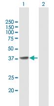 Anti-CDK6 Mouse Polyclonal Antibody