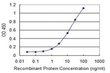 Anti-DDAH2 Mouse Monoclonal Antibody [clone: 3E3]