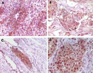 Anti-RAB25 Mouse Monoclonal Antibody [clone: 3F12F3]