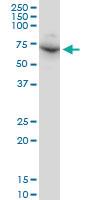 Anti-DDX56 Mouse Monoclonal Antibody [clone: 6B9]