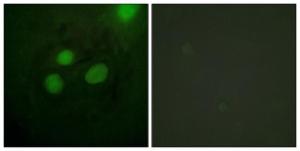 Immunofluorescence analysis of HeLa cells using Anti-RFA2 Antibody. The right hand panel represents a negative control, where the antibody was pre-incubated with the immunising peptide