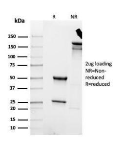 SDS-PAGE analysis of Anti-Cytokeratin 8 Antibody [rKRT8/4209] under non-reduced and reduced conditions; showing intact IgG and intact heavy and light chains, respectively. SDS-PAGE analysis confirms the integrity and purity of the antibody.