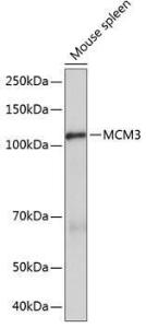 Western blot analysis of extracts of Mouse spleen, using Anti-MCM3 Antibody [ARC0607] (A306905) at 1:1,000 dilution The secondary antibody was Goat Anti-Rabbit IgG H&L Antibody (HRP) at 1:10,000 dilution Lysates/proteins were present at 25 µg per lane