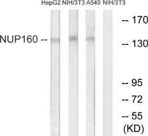 Anti-NUP160 antibody