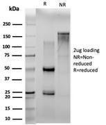 SDS-PAGE analysis of Anti-N Myc Interactor Antibody [PCRP-NMI-1C1] under non-reduced and reduced conditions; showing intact IgG and intact heavy and light chains, respectively. SDS-PAGE analysis confirms the integrity and purity of the antibody