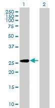 Anti-GPC5 Mouse Polyclonal Antibody