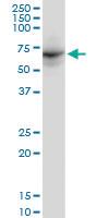 Anti-DDX56 Mouse Monoclonal Antibody [clone: 6B9]