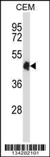 Anti-CREB5 Rabbit Polyclonal Antibody (APC (Allophycocyanin))