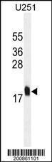 Anti-MCFD2 Mouse Monoclonal Antibody (HRP (Horseradish Peroxidase)) [clone: 165CT13.1.6]