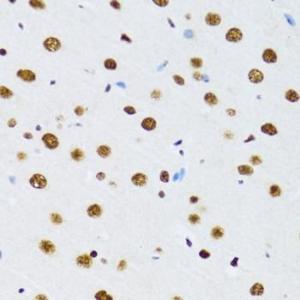 Immunohistochemistry analysis of paraffin-embedded rat brain using Anti-UAP56 Antibody (A12241) at a dilution of 1:100 (40x lens). Perform microwave antigen retrieval with 10 mM PBS buffer pH 7.2 before commencing with IHC staining protocol.