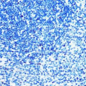 Immunohistochemistry analysis of paraffin-embedded rat spleen using Anti-MCM3 Antibody [ARC0607] (A306905) at a dilution of 1:100 (40x lens) Perform microwave antigen retrieval with 10 mM PBS buffer pH 72 before commencing with IHC staining protocol