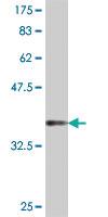 Anti-FGGY Mouse Polyclonal Antibody