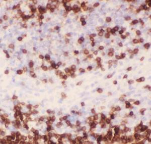 Anti-CD3 Epsilon Polyclonal Antibody