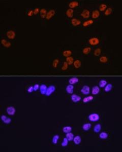 Immunofluorescence analysis of HeLa cells using Anti-MCM3 Antibody [ARC0607] (A306905) at a dilution of 1:100 (40x lens) DAPI was used to stain the cell nuclei (blue)