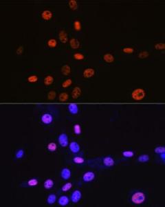 Immunofluorescence analysis of NIH-3T3 cells using Anti-MCM3 Antibody [ARC0607] (A306905) at a dilution of 1:100 (40x lens) DAPI was used to stain the cell nuclei (blue)