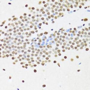 Immunohistochemistry analysis of paraffin-embedded mouse brain using Anti-UAP56 Antibody (A12241) at a dilution of 1:100 (40x lens). Perform microwave antigen retrieval with 10 mM PBS buffer pH 7.2 before commencing with IHC staining protocol.