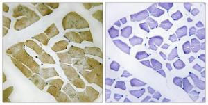 Immunohistochemical analysis of paraffin-embedded human skeletal muscle using Anti-MYH4 Antibody. The right hand panel represents a negative control, where the antibody was pre-incubated with the immunising peptide