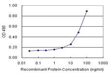 Anti-F11R Antibody Pair