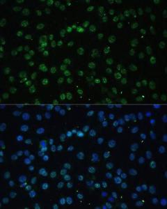 Immunofluorescence analysis of C6 cells using Anti-UAP56 Antibody (A12241) at a dilution of 1:100 (40x lens). DAPI was used to stain the cell nuclei (blue).