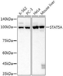 Anti-STAT5 Rabbit Monoclonal Antibody [clone: ARC52814]