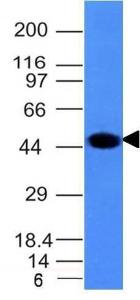 Western blot analysis of A431 cell lysate using Anti-Cytokeratin 8 Antibody [H1]