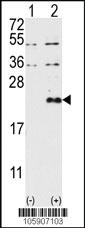 Anti-DUSP13-M1 Rabbit Polyclonal Antibody