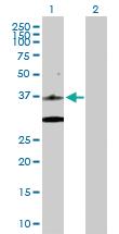 Anti-CDK6 Rabbit Polyclonal Antibody