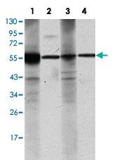 Anti-ALDH1A1 Mouse Monoclonal Antibody [clone: 5A11]