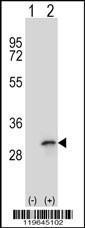 Anti-FHL1 Rabbit Polyclonal Antibody