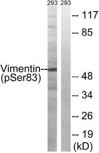 Anti-Vimentin