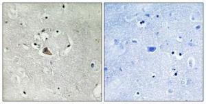 Immunohistochemical analysis of paraffin-embedded human brain using Anti-MUC1 Antibody 1:100 (4°C overnight). The right hand panel represents a negative control, where the antibody was pre-incubated with the immunising peptide