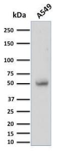 Antibody anti-CD14 LPSR2397 BSA 100 µg