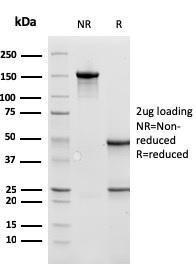 SDS-PAGE analysis of Anti-Cathepsin D Antibody [CTSD/3275] under non-reduced and reduced conditions; showing intact IgG and intact heavy and light chains, respectively. SDS-PAGE analysis confirms the integrity and purity of the antibody