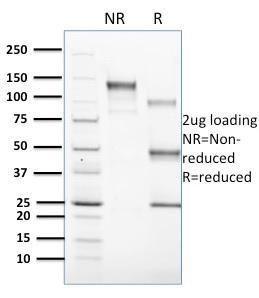 SDS-PAGE analysis of Anti-CD1c Antibody [CD1C/1603] under non-reduced and reduced conditions; showing intact IgG and intact heavy and light chains, respectively. SDS-PAGE analysis confirms the integrity and purity of the antibody.