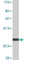 Anti-FGGY Mouse Monoclonal Antibody [clone: 3B9]