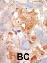 Anti-SCFR Rabbit Polyclonal Antibody (HRP (Horseradish Peroxidase))