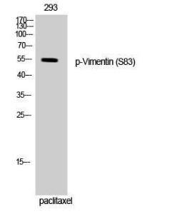 Anti-Vimentin