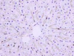 Anti-TRPM2 Rabbit Polyclonal Antibody