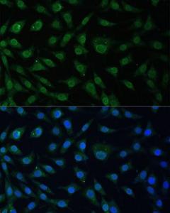 Anti-NUP214 Rabbit Polyclonal Antibody