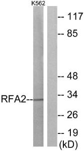 Western blot analysis of lysates from K562 cells using Anti-RFA2 Antibody. The right hand lane represents a negative control, where the antibody is blocked by the immunising peptide