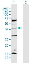 Anti-CDK6 Rabbit Polyclonal Antibody