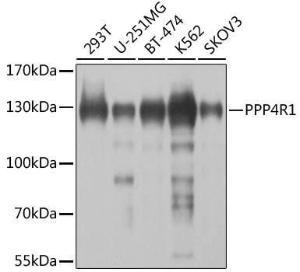 Western blot analysis of extracts of various cell lines, using Anti-PPP4R1 Antibody (A12243) at 1:1000 dilution