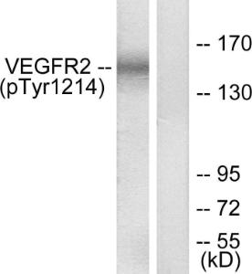 Western blot analysis of lysates from HepG2 cells treated with Na3VO4 03nM 40' using Anti-VEGFR2 (phospho Tyr1214) Antibody The right hand lane represents a negative control, where the antibody is blocked by the immunising peptide