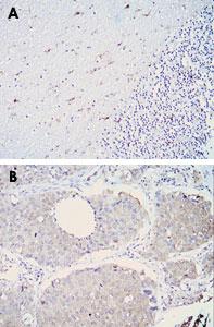 Anti-ALDH1A1 Mouse Monoclonal Antibody [clone: 5A11]