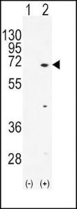 Anti-TXK Rabbit Polyclonal Antibody (HRP (Horseradish Peroxidase))